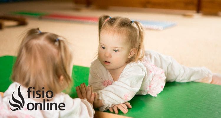 bebes con sindrome de down recien nacidos caracteristicas